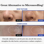 Lift Mini — 3-in-1 HIFU