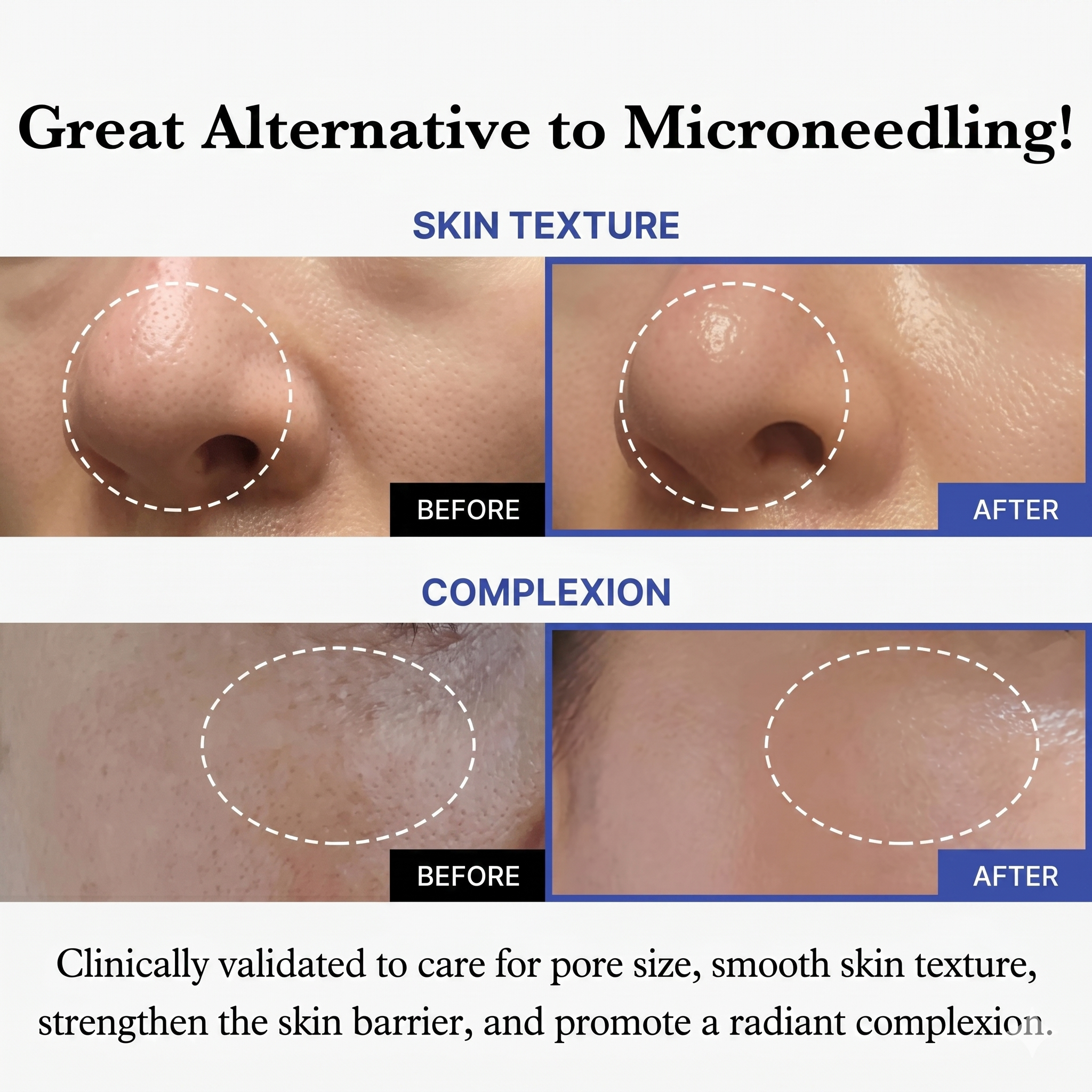 Lift Mini — 3-in-1 HIFU