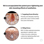 Lift Mini — 3-in-1 HIFU